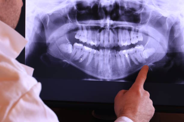 Best Broken or Cracked Tooth Emergency Dentist in Marlboro Village, MD