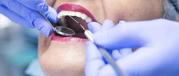 Best Emergency Dental Extractions in Marlboro Village, MD
